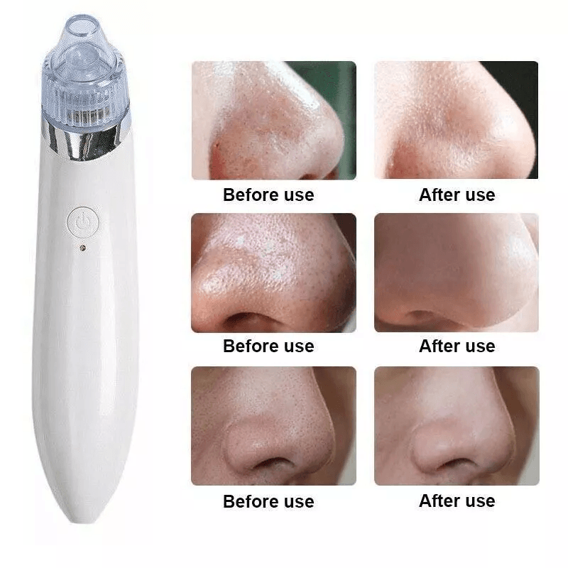 Electric Facial Skin Care Pore Blackhead Cleaner Remover Vacuum Professional Acne Cleanser  Comedon 4