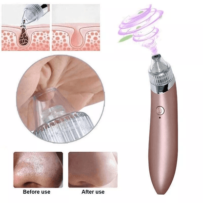 Electric Facial Skin Care Pore Blackhead Cleaner Remover Vacuum Professional Acne Cleanser  Comedon 2