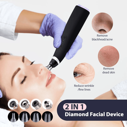 Portable Diamond Microdermabrasion Device – Exfoliating Vacuum Blackhead Remover for Deep Facial Cleansing