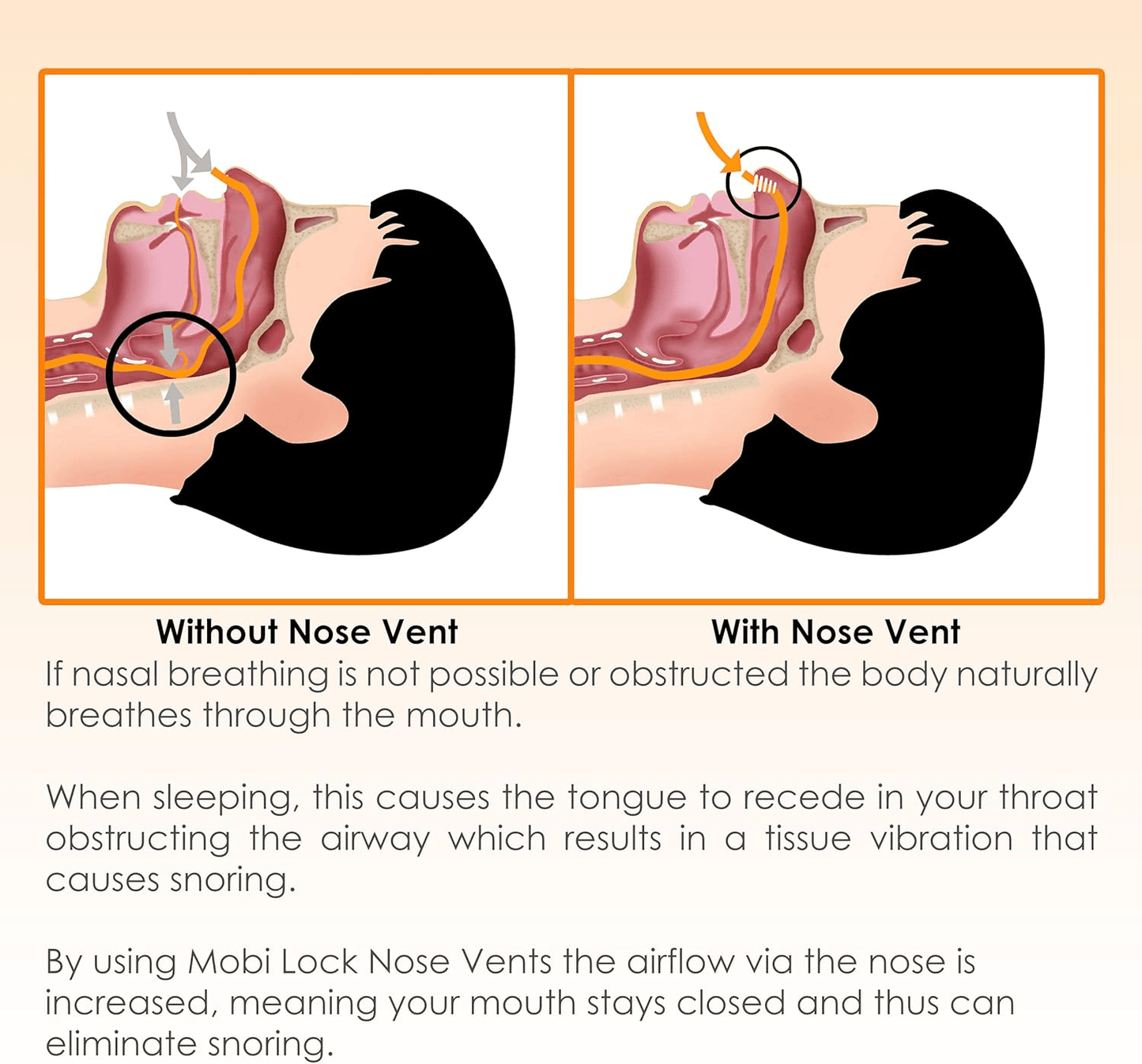 Anti Snore Nose Clip Set Comfortable Nasal Dilators For Snoring  Sleep Apnea Relief 9