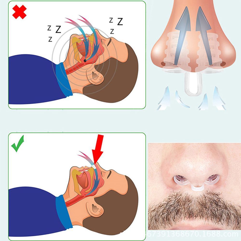 Anti Snore Nose Clip Set Comfortable Nasal Dilators For Snoring  Sleep Apnea Relief 6
