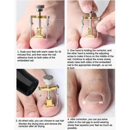 Ingrown Toenail Treatment Clip Pedicure Tool For Foot Care Stainless Steel Onyxis Correction Straig 5